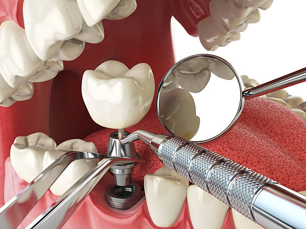 Best Knocked-Out Tooth Emergency  in Chickasha, OK